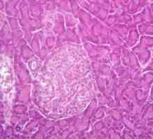 Structura neomogenă a parenchimului pancreatic, ce este?
