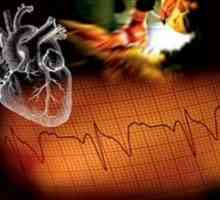 Urgente in Cardiologie: tratament