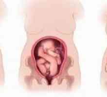 Poziția greșită și prezentarea fătului în timpul sarcinii