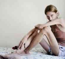 Anorexia nervoasa: tratament, simptome, semne, cauze