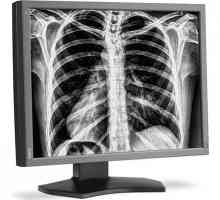 Noul monitor pentru radiologi