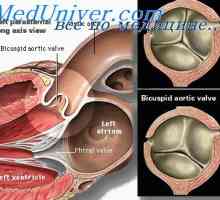 Educație valve aortice. Separarea trunchiului arterial fetal