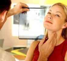Evaluarea pacienților cu noduli tiroidieni