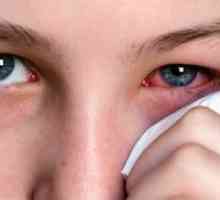 Ophthalmoherpes: tratament, simptome