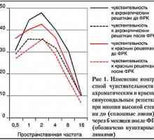 Sensibilitate Oftalmologie contrast la diferite erori de refracție înainte și după Ceratectomie…