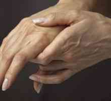 Ocluzia extremităților superioare (mâini, degete): Tratament, cauze, simptome