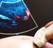 Este periculos cu ultrasunete?
