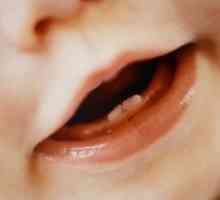 Anomalii ortodontice în dinți pentru copii