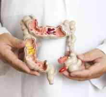 Complicațiile și prognosticul bolii Crohn