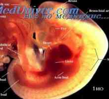 Particularitățile de diagnostic de sindroame fetale. Ahondrogenez și frecvența