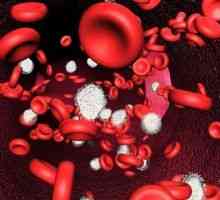Anemia acută care rezultă din pierderea de sânge