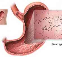 Gastroenterită infecțioasă acută
