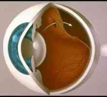 Ochii dezlipirea de retină: cauze, simptome, tratament, simptome