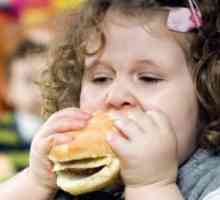 Obezitatea la copii: tratament, cauze, dieta, prevenirea