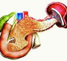 Pancreatita ereditara: simptome, tratament, simptome, cauze