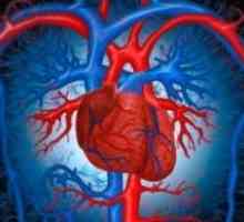 Patogeneza insuficienței circulatorii
