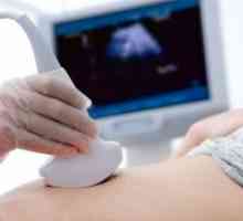Patologia perioadei dezvoltării fetale