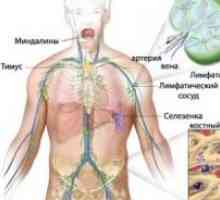 Limfomul sistemului nervos central primar