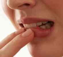 Carcinomul scuamos al cavității orale: tratament, simptome, prognosticul