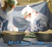 Selectarea transplantului de rinichi. echipament