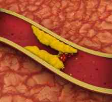 Pancreas și colesterol