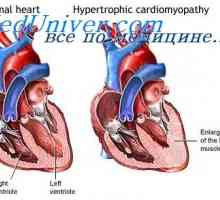 Musculare fluxul de sânge. Hipertrofia inimii în timpul antrenamentului