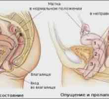 Malformații ale uterului: diagnostic si tratament