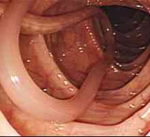 Consecințele și complicații ale viermilor intestinali la om