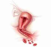 Postpartum hemoragie: cauze, tratament, prevenire