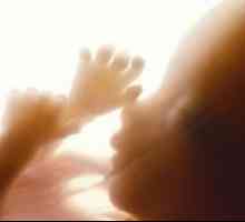 Prezentare și pierderi fetale bucăți mici (brațe și picioare), și bucla din cordonul ombilical