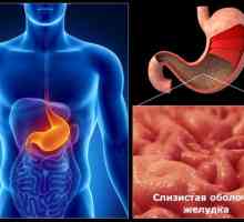 Cauzele gastrită cronică