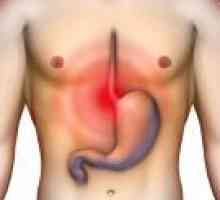Cauzele ulcerului gastric. De ce este ciuma?
