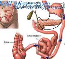 Semne de sarcină non-uterin. În curs de dezvoltare semne Dopplerographic unei sarcini extrauterine