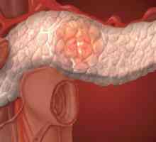 Prevenirea și tratamentul bolilor pancreasului și pancreatită cronică