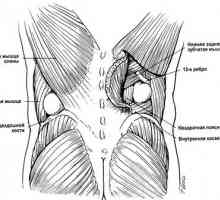 Herniile peretelui abdominal ombilicale și alte. hernie lombare