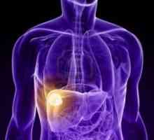 Cancerul pulmonar: Simptome, stadiu, tratament, simptome, masura, prognostic, diagnostic