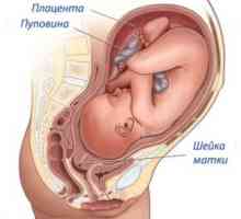 Colului uterin înainte de naștere, simptome, semne