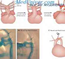 Dezvoltarea sistemului vascular arterial. Etapele formării aortă fetale