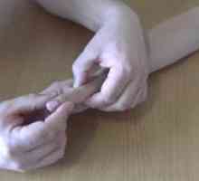 Reconstrucția tendonului extensor al degetelor