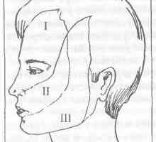 Rolul nervului trigemen în durerea facială