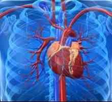 Insuficienta cardiaca in cardioscleroză aterosclerotice, tratament, cauze