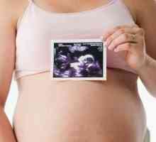 Pelvis al femeilor gravide