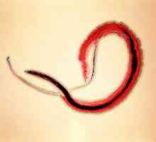Bilharzia (schistosomiasis, bilharzia), agentul cauzal al sângelui (japonez) trematode