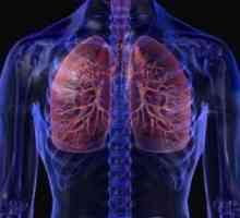 Silicoza, pulmonare: simptome, tratament, diagnostic, cauze, simptome