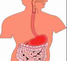 Simptome gastroduodenita