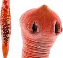 Simptome viermi (helminți) și conducte biliare