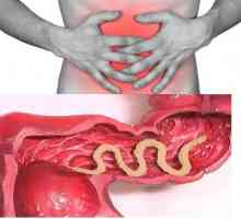 Simptomele și tratamentul viermilor intestinali (invazia antihelmitice helminți) la adulți