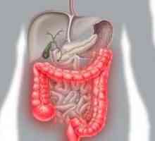 Simptomele si tratamentul sindromului de colon iritabil membranoasă