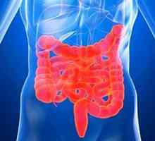Simptomele sindromului de intestin iritabil (IBS)