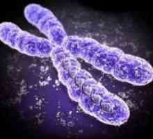 Sindromul cromozomului X fragil la copii